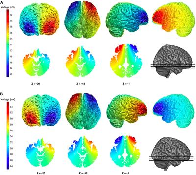 Transcranial direct current stimulation (tDCS) over the orbitofrontal cortex reduces delay discounting